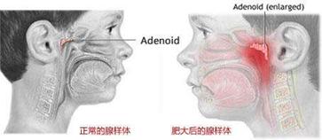 [你的育儿经]宝宝睡觉打鼾？张嘴呼吸？别以为这不是事！