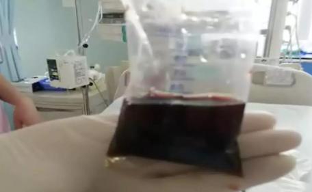 [你的育儿经]差点没命！孩子高烧，爸妈在家“自诊”……这几种情况，一定要去医院