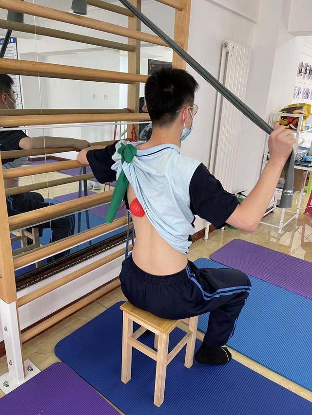 脊柱|脊柱弯曲超135度，19岁女孩“矮了”13厘米