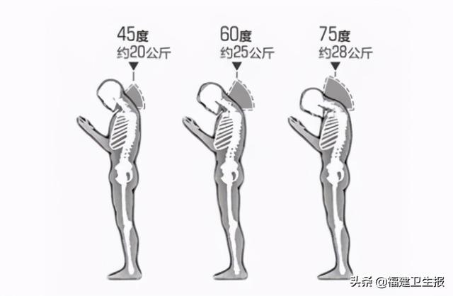 颈椎|一男子莫名头晕失眠、手指发麻……医生一查，病根竟在颈椎上