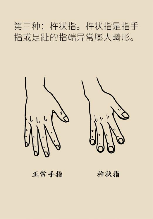 肩背痛竟然是肺癌？小心这些被忽视的?肿瘤信号?