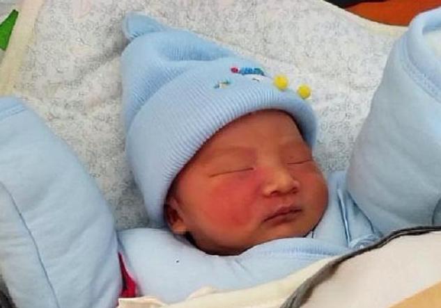 你的育儿经|胎记是怎么回事？产科医生：除遗传，怀孕时这3种行为注意避开