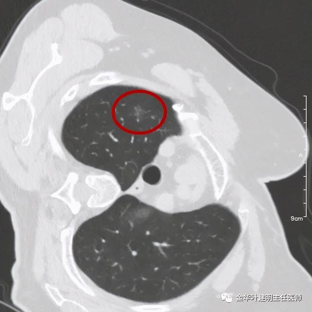 如此违反原则的手术方案设计，你支持吗？
