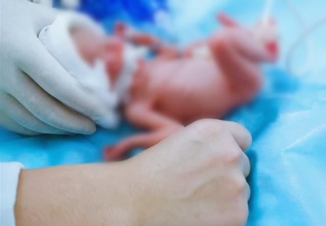 宝宝|出生体重仅550克！“手掌姑娘”的惊心脱险记