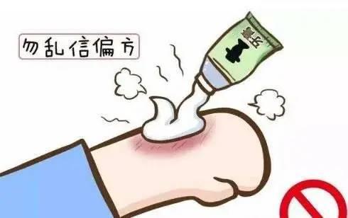 #你的育儿经#孩子烫伤该怎么办？牙膏涂抹可以吗？很多人第一步就不对