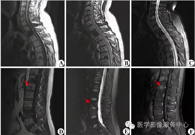 77种骨肌影像病例，助你诊断无忧