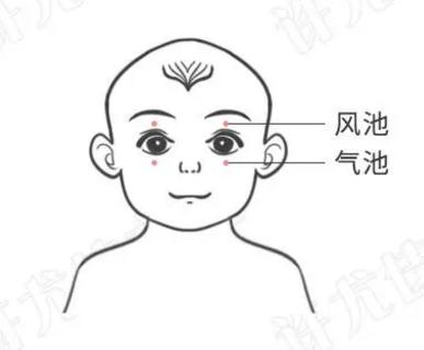 眼袋|孩子小小年纪眼袋就很重？可能是长期脾虚