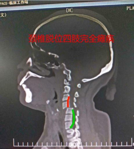 这一周之内的经历足以让她记一辈子，还好，她是幸运的