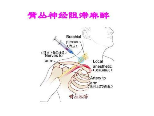 麻醉以后就真的感觉不到疼痛吗？