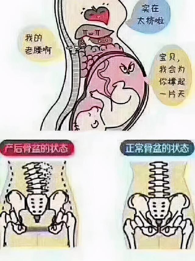 生娃后变胖，胯骨变宽？骨盆没聚合才是根本原因