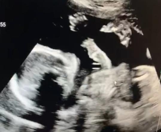 32岁说唱歌手官宣妻子怀孕喜讯，晒与小8岁娇妻贴鼻尖照太甜蜜影视交流地