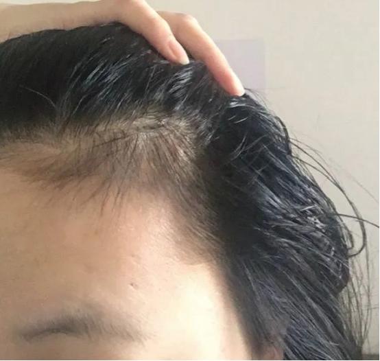 天空的彩虹|原来怀孕生孩子竟然能长高？你长高了吗？
