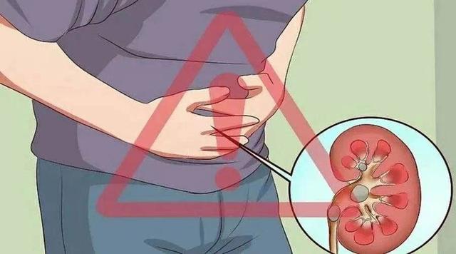 肾脏病|积极面对肾病 尽享幸福生活