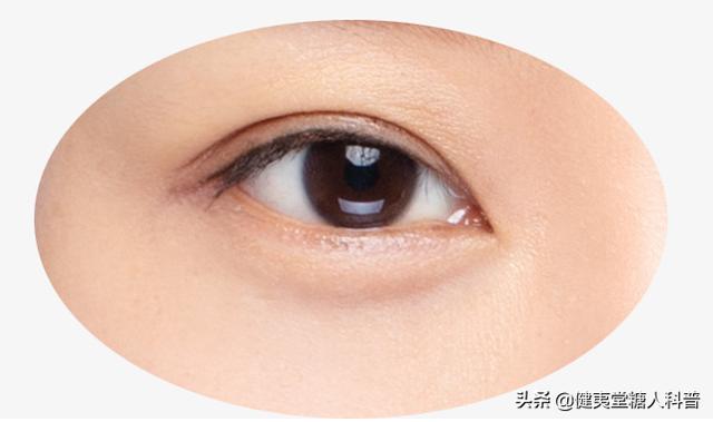 高血糖会危害心灵之窗，糖友须悉心呵护