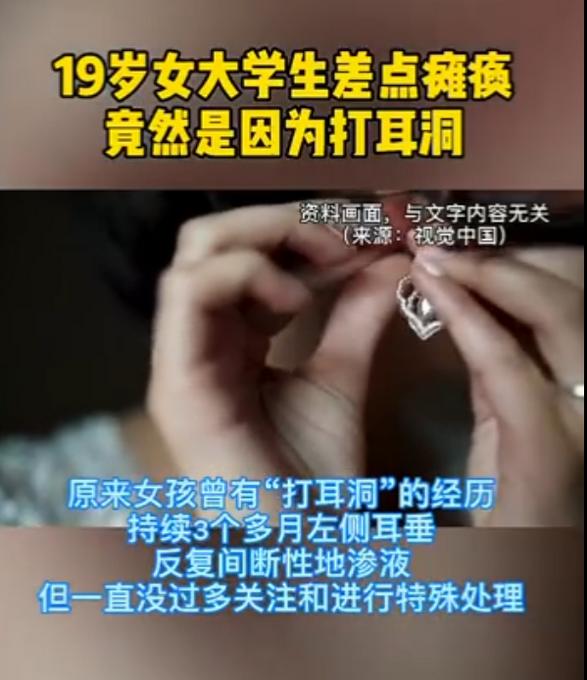 耳洞|19岁女大学生差点儿瘫痪，“元凶”竟是因为打耳洞