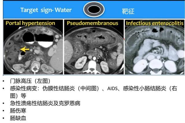 什么是 CT 增强？强化程度、模式、扫描时相等问题逐一解答