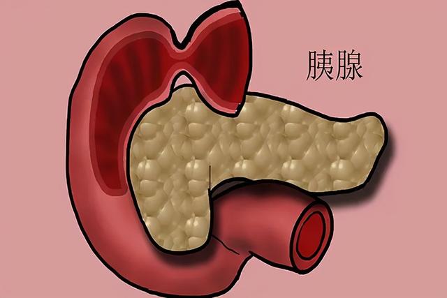 为何胰腺癌被称为“万癌之王”？医生：了解4点，大概心中有数了