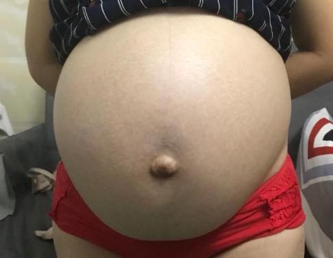 粉红夏季|“贴身物湿湿的,是不是要生了”可能有这一原因