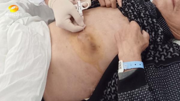 医院|81岁嗲嗲患乳腺癌？！男同胞们进来看……