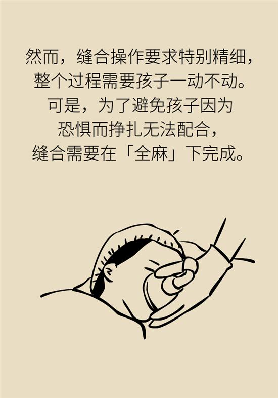 『超级宝妈』全麻，究竟会不会影响孩子的智力发育？