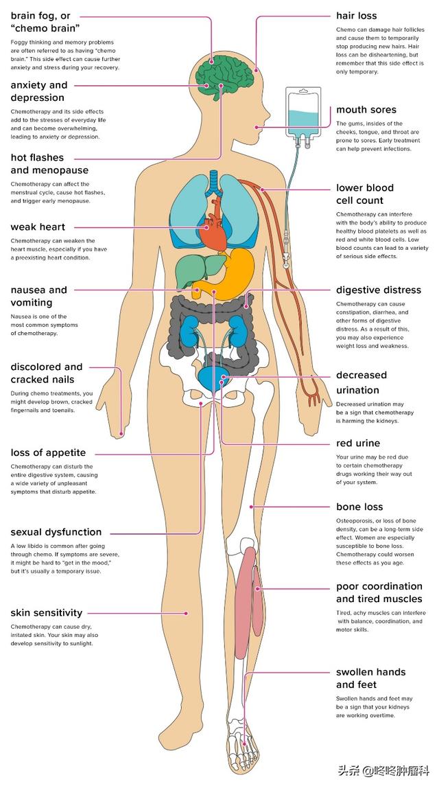 化疗的常见副作用及处理方法