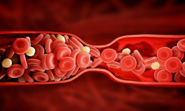 血管被堵会产生哪些影响？这5个部位的血管被堵，需多加重视