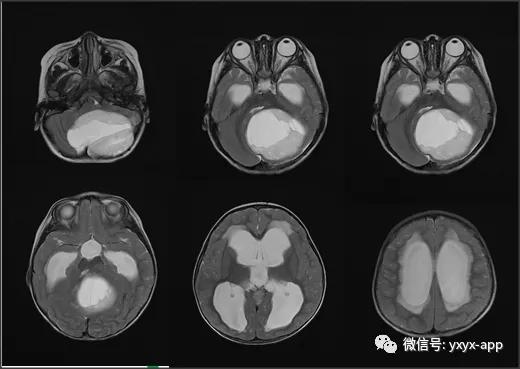 经典病例分享