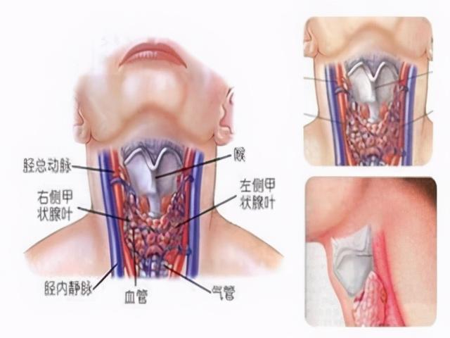 哪些病查出不用治？哪些病一定不能“拖”？医生教你巧分辨