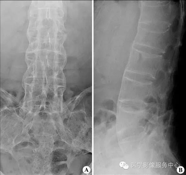 77种骨肌影像病例，助你诊断无忧