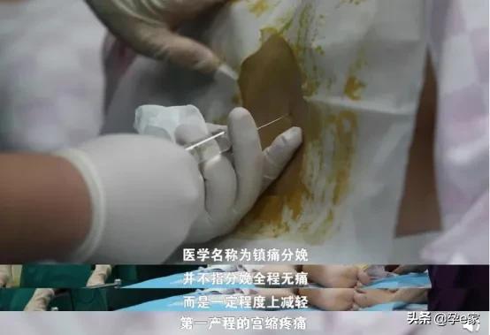 奋斗吧小青年|27岁妈妈直播分娩过程，揭秘产房「无痛」真相