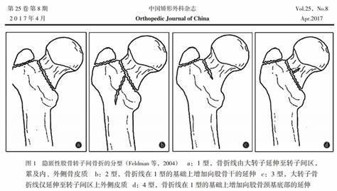 患者|这个症状，平均5人里面就有1人在患，医生提醒：鉴别诊断很重要！