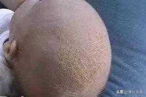 温暖的襁褓|宝妈太爱干净，出生15天后，孩子被送到了医院，医生责备宝妈无知