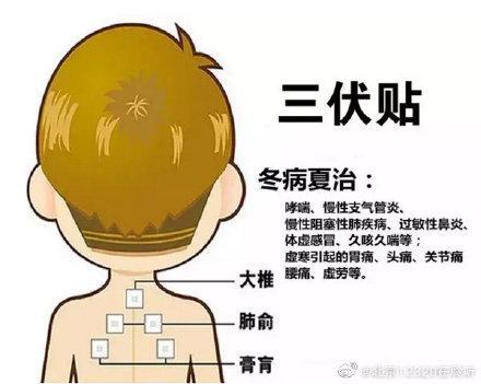 伏贴|三伏贴是不是什么病都能治