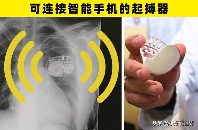 可以为人类健康带来帮助的6个科学技术进步