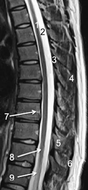 ռ׵ MRI ͼ