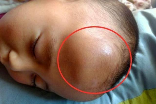 1岁宝宝摔下床，妈妈的做法让婆婆直呼冷血，医生却说：做的对