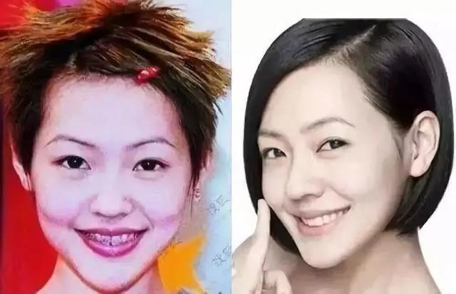 戴上这个神奇牙套，舌头就能当鼠标