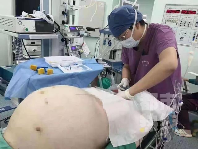 小王|西安21岁女孩腹部肿胀宛如怀孕，一查竟是……