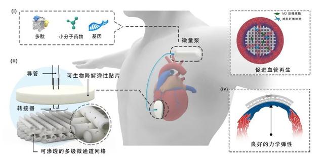 手术|赵强：开别人不敢碰的刀