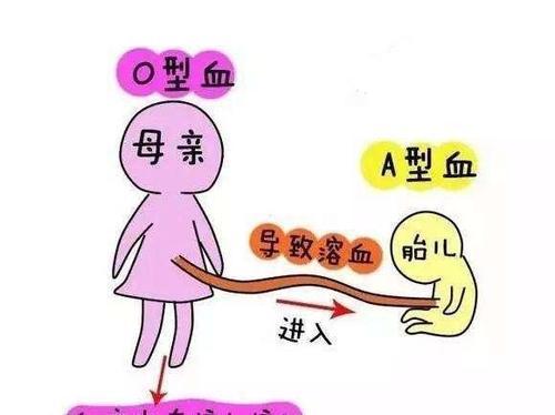 「你的育儿经」听说过“八字不合”,但夫妻“血型不合”才最危险,孕前需检查