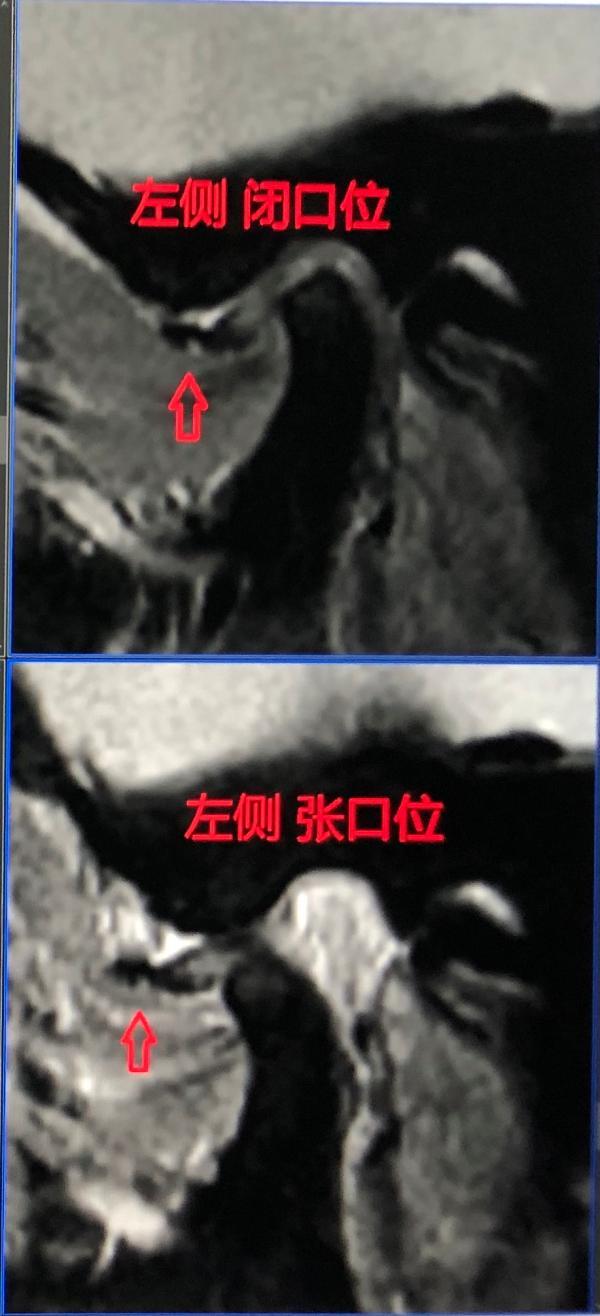 惊！女子下巴歪了！医生：已到晚期