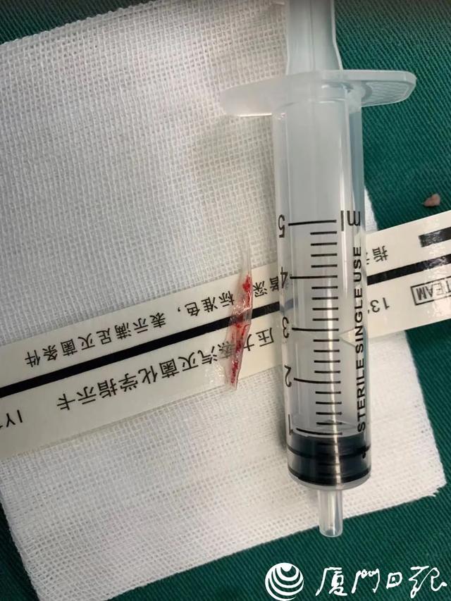 男子发烧休克，被送进ICU！还有人血管大出血导致死亡，只因为吃饭时没注意这个