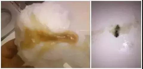 【你的育儿经】宝宝流鼻涕≠感冒，发现这种鼻涕要特别当心