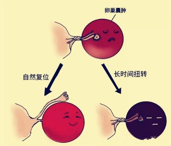 #超级宝妈#12周二胎孕妈腹痛难忍 咸阳市第一人民医院上演乾坤大扭转保母子平安