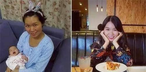 超级宝妈▲生娃有多“伤身”？看完这位双胞胎妈妈生娃前后对比照，直喊可怕
