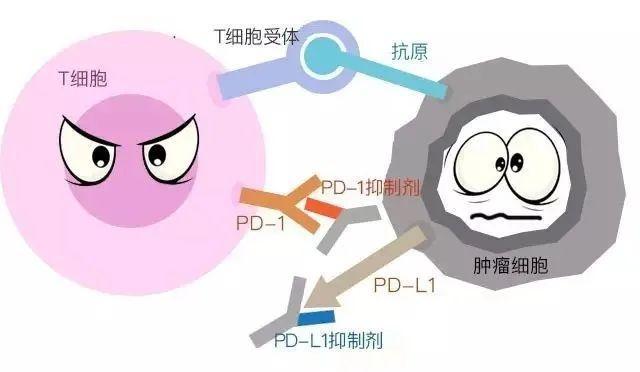 癌细胞“清零”？胃癌晚期的杭州大伯靠这项技术重获新生