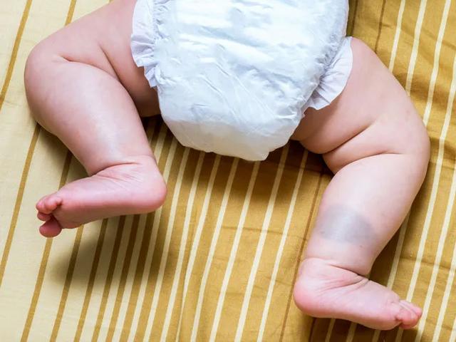 「超级宝妈」新生宝宝的这些现象令人担忧？有些不必担心，但有些一定要注意