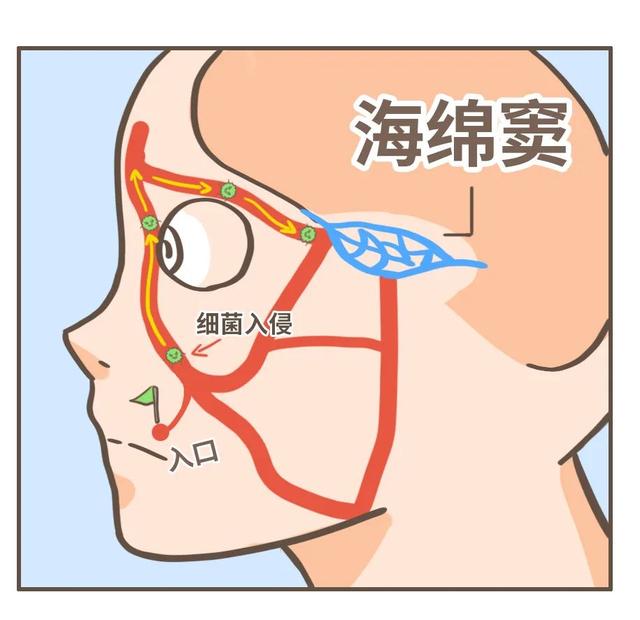 挤痘一时爽，颅内火葬场