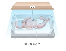 #你的育儿经#新生儿黄疸，茵栀黄，益生菌有用吗？
