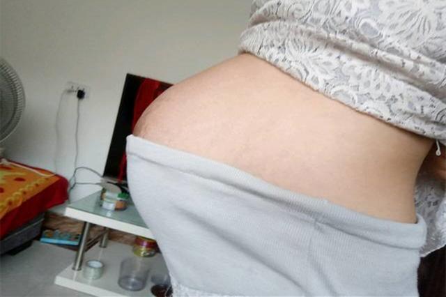 超级宝妈|孕妇“悬浮肚”是咋回事？跟多胞胎关系不大，可能是“头盆不称”